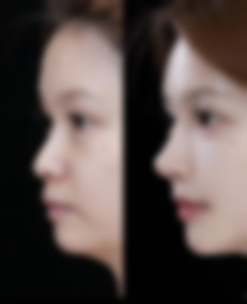 郑州张喜兰整形医疗美容诊所口碑如何