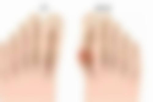 视网膜色素变性现在能治吗？杭州三等甲医院有何新进展？