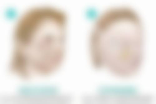 深圳做妇科手术哪个医院更好