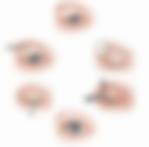 重睑成形术、提眉术与眼睑松弛矫正术，全方面解决多眼皮问题？