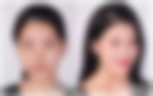 北京男性私密整形收费价格表，收费贵不贵？价格构成是怎样的？详解北京泰悦医疗“一人一策”方案与生物补片增粗术费用组成