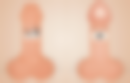 3. 武汉艺星医疗美容医院——民营口碑标杆，紧缩针+手术双项出色