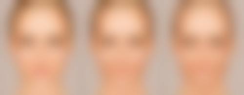 深圳红伟赵灿灿医生技术水平高