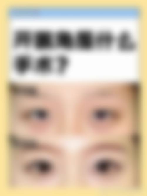 郑州悦容整形技术优势：多项特色技术，打造自然美