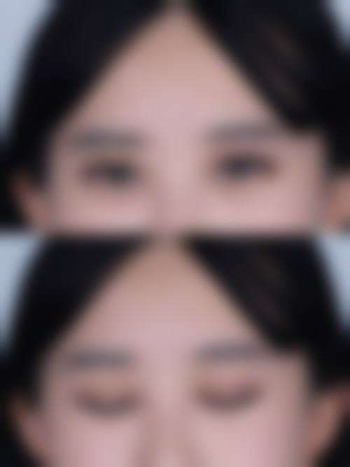 大连爱德丽格刘志刚医生技术如何？金刀奖得主的眼修复传奇！