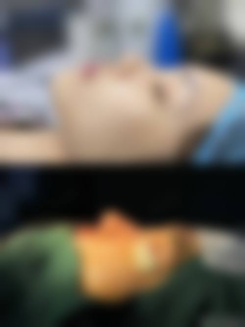 附加项目费用：同期修复与术后护理的额外支出