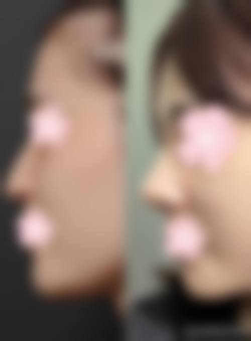 杭州天鑫医疗美容医院预约挂号攻略，轻松get变得更美名额