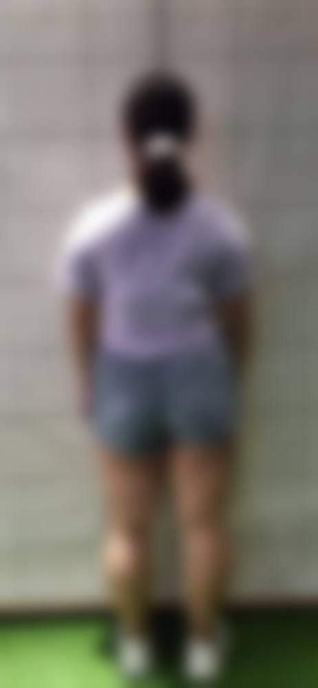 如何选择面部吸脂的医院和医生？