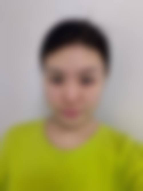 十一、长春奥拉克美容医院真人口碑实例评价一览