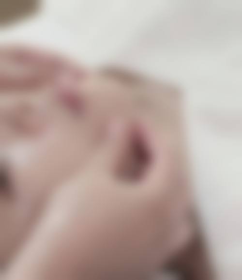 武汉五洲整形眼部骨干医生谁更牛？严飞医生20年经验实例解析