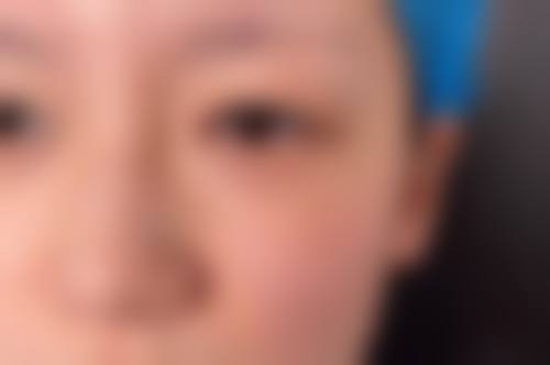 赵俊祥医生擅长项目