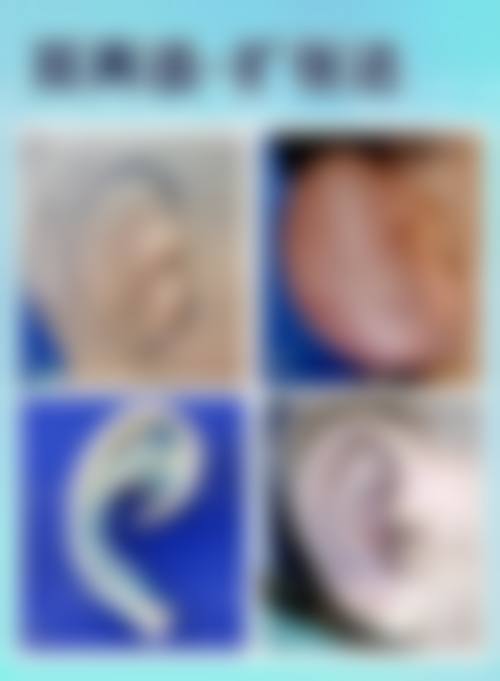 杭州天鑫医疗美容医院是私人的还是公立的？答案来了，它是私立医院，口碑评价还挺不错！看这吸脂、双眼皮、隆鼻项目效果，就知道为啥常年上榜前十了！