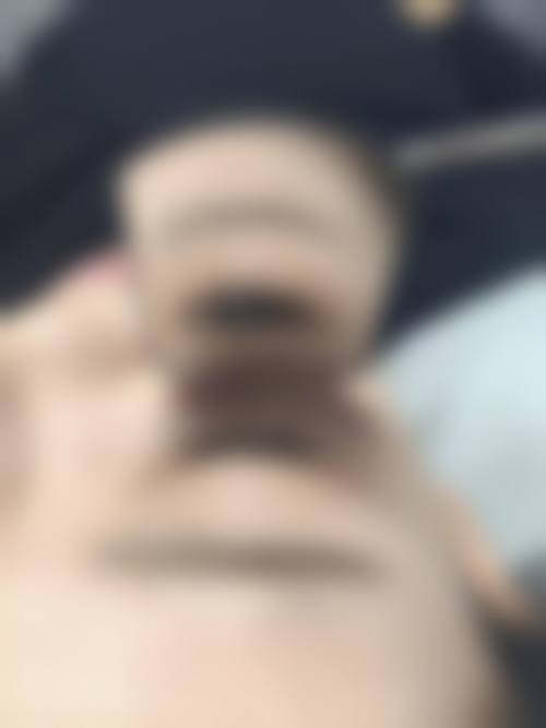 八、宁波大麦植发医院（原科发源）收费价格表