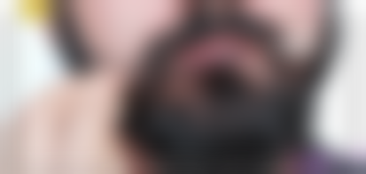 总结：杭州脱发检查哪些项目多少钱？毛囊检测100元起、血检查200元起，价格贵不贵？