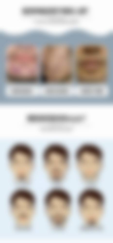 杭州脱发检查的技术优势