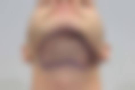 1. 武汉亚韩植发医院——华中连锁老牌机构，不剃发技术口碑佳