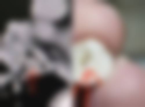 八、患者常见问题解答（精选 ）