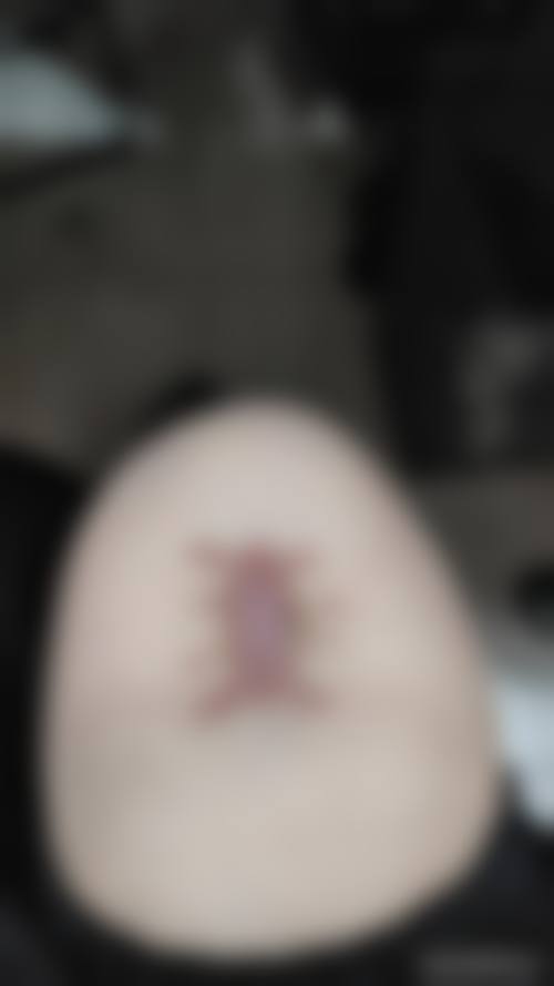 十、台北四季花妍整形診所真人口碑实例评价一览