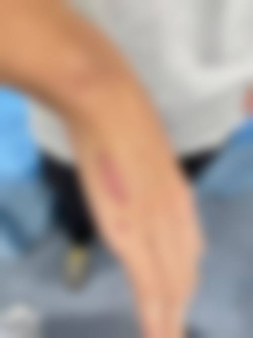 适合人群与修复周期