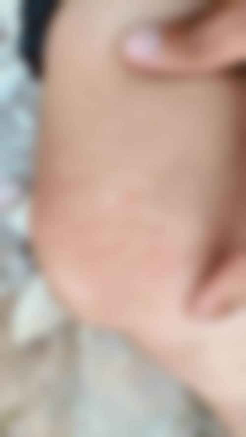 star整形外科特色技术