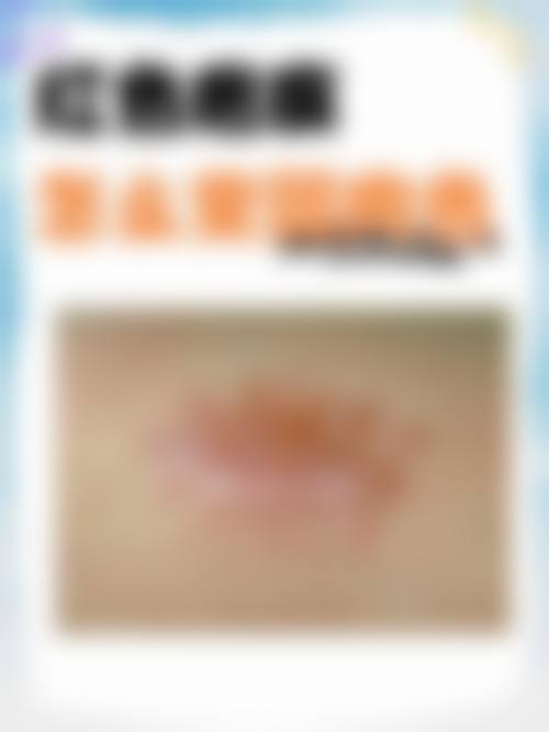 患者常见问题解答（精选 ）