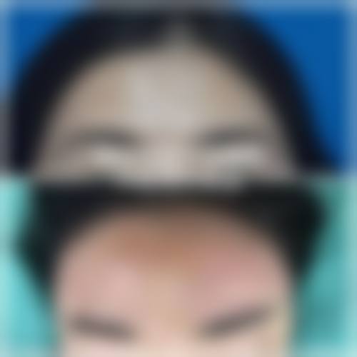 七、阳水发医生整形项目价格表/收费标准一览（2026年全新）