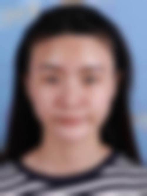 杭州连天美医疗美容医院项目价格差异核心：术式、材质、医生的影响