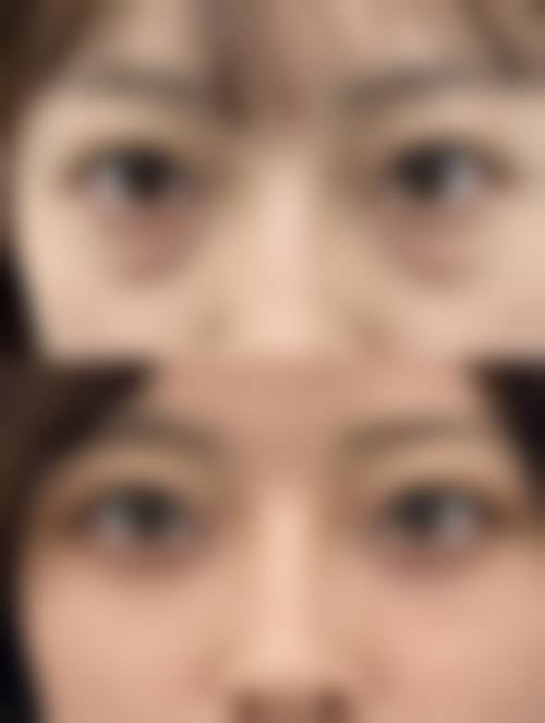 项目优势及适应人群