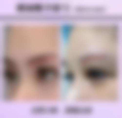 五、患者参考信息