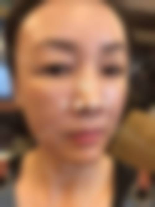 重庆整容面部填充多少钱及医院哪家好？