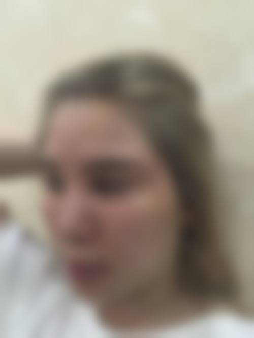 重庆面部填充价格影响因素及技术优势