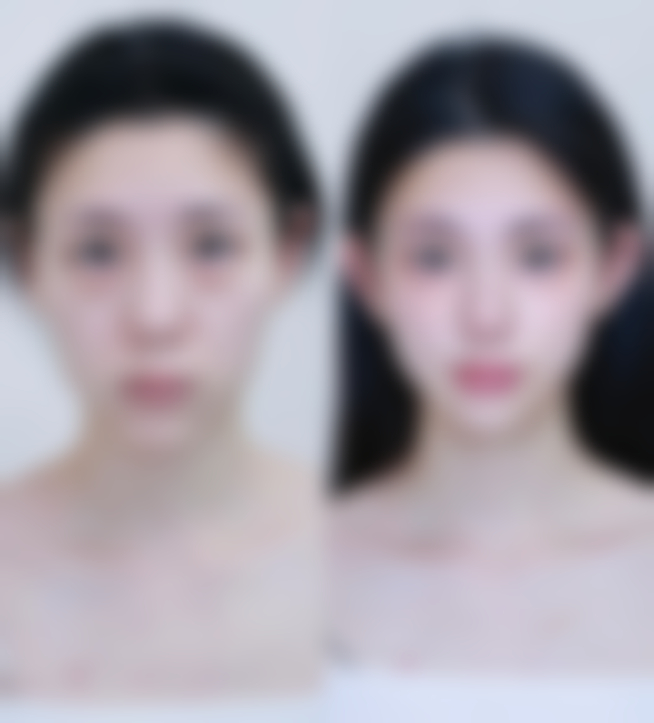 深圳阴道紧缩医院