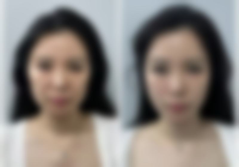 大连爱德丽格医疗美容门诊部是正规医院吗？它资质靠谱且口碑超棒，可以闭眼冲！刘志刚院长亲诊双眼皮修复48000起，6000㎡独栋医院获国际认证！