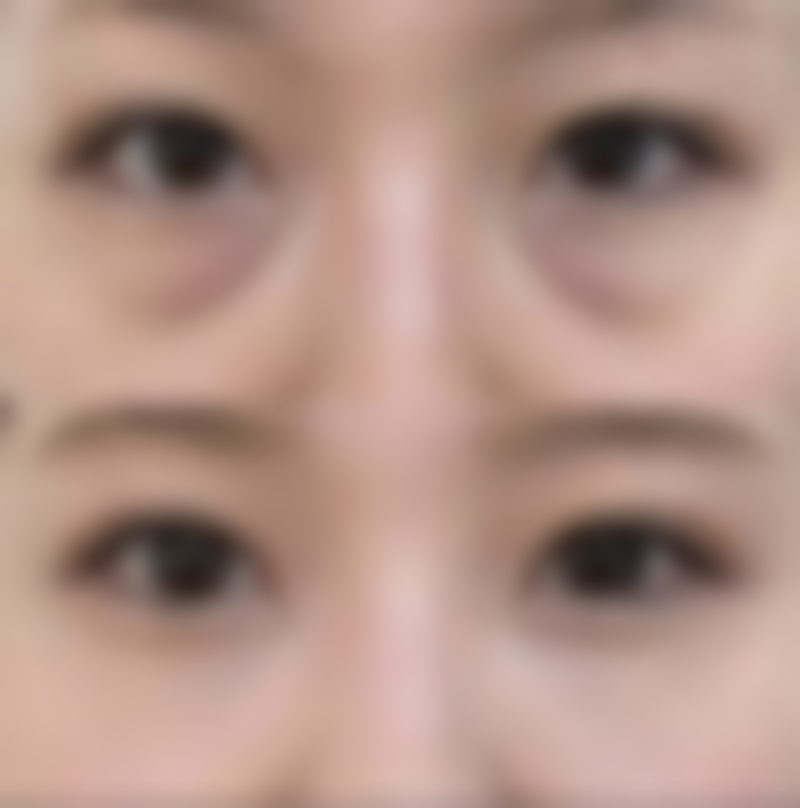 刘成玉医生擅长项目