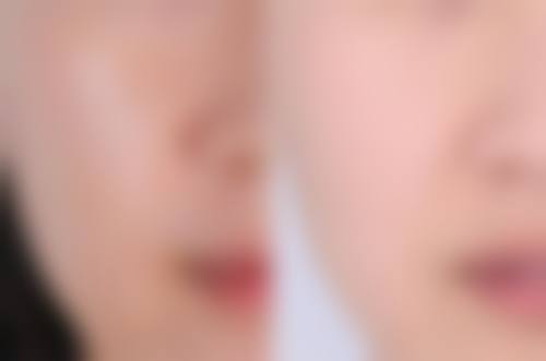 杭州地区排名前三的医院爱拉丝提玻尿酸收费价目表