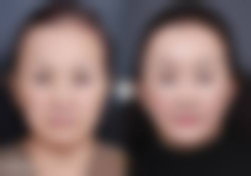 沈小雁医生预约挂号指南