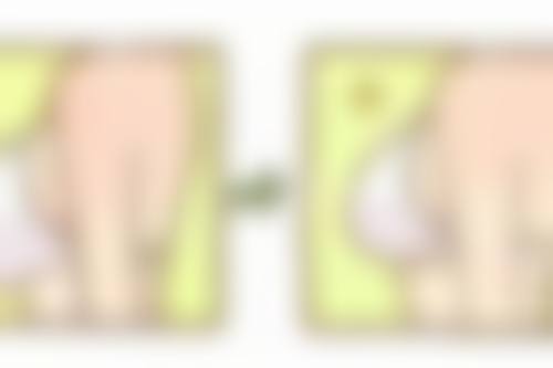 哪些情况会让隆胸假体不得不取出?特定情况大揭秘