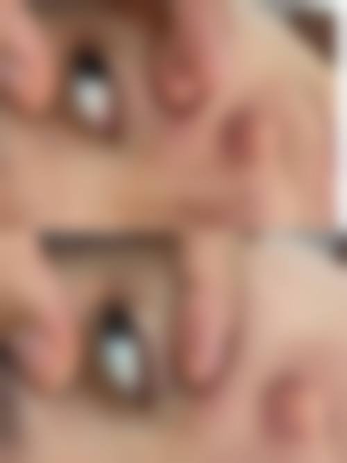 9. 沈阳及云丽医疗美容诊所——个性化方案成就理想双眼皮修复