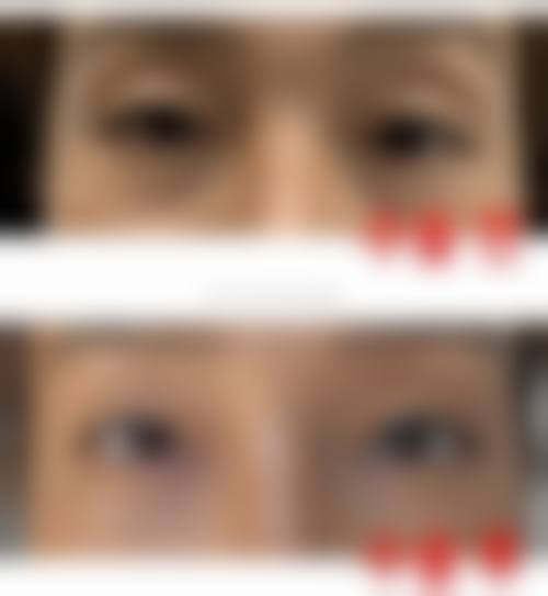 总结：为什么选择优雅人？正规医院的核心价值