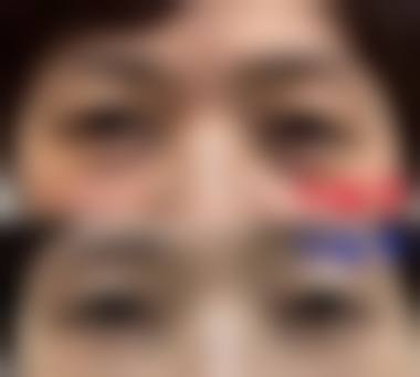 韩国优雅人整形外科医院价格：透明化收费标准大公开