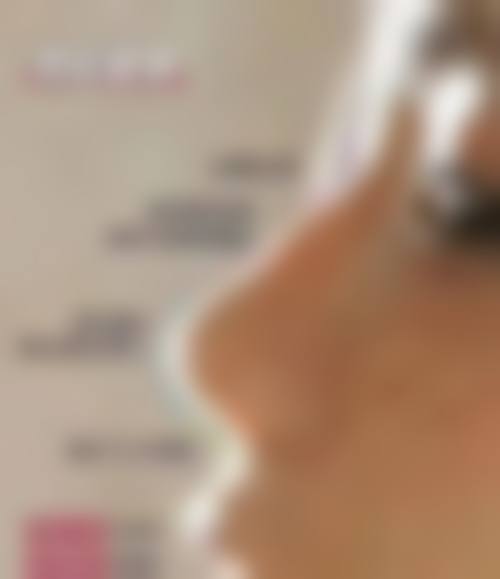 热门项目：从五官整形到吸脂塑形，覆盖全品类塑美需求