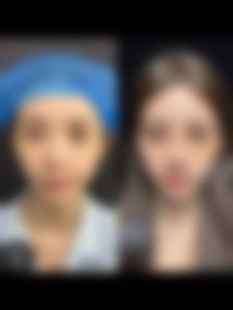 三、预约后专属服务：3D模拟面诊+0.5毫米级个性化方案定制