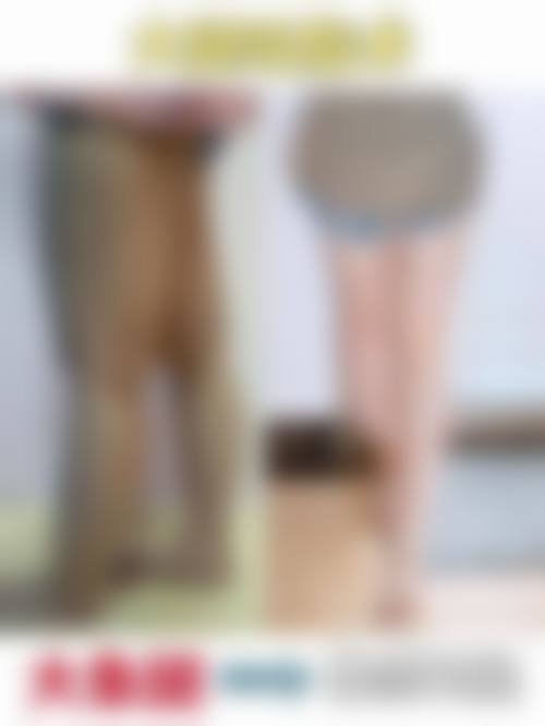 吸脂量和大腿吸脂术后修复有什么关联?