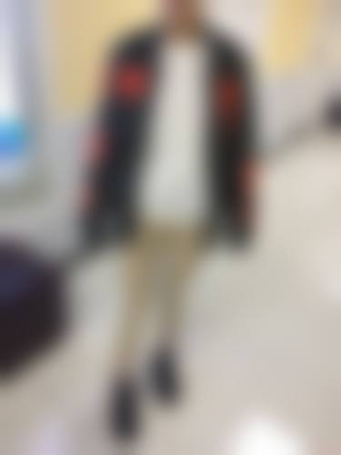 不同人群的大腿单侧吸脂合理范围是多少?