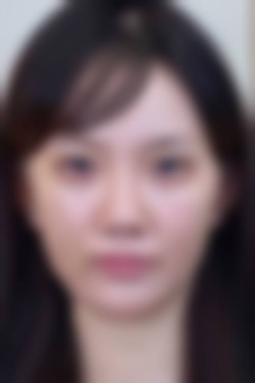 郑州热玛吉法定认证医院查询：这些医院靠谱吗，收费贵不贵？ 明细介绍