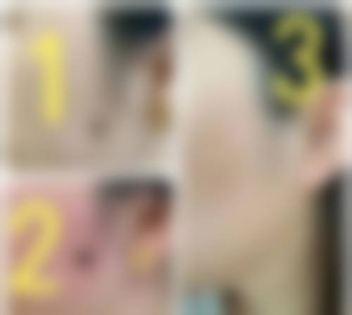 2、【伊维度无痕美眼术】核心技术优势