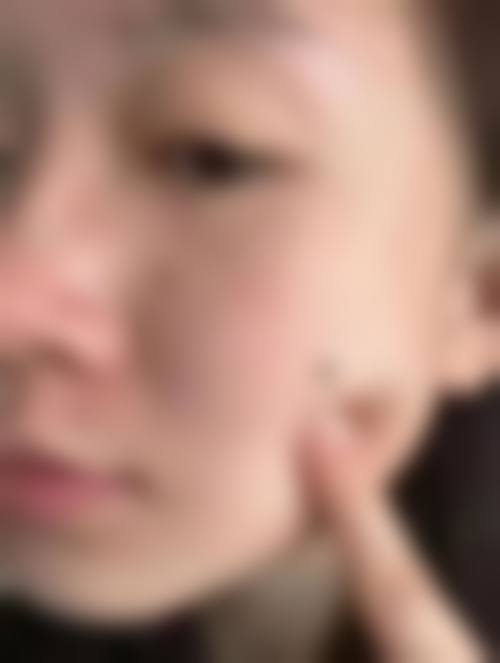 五、患者参考信息