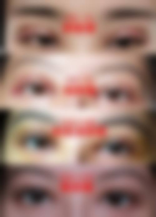 十、选择疤痕体质适合的双眼皮手术相关医院与医生时,应重点看哪些维度?