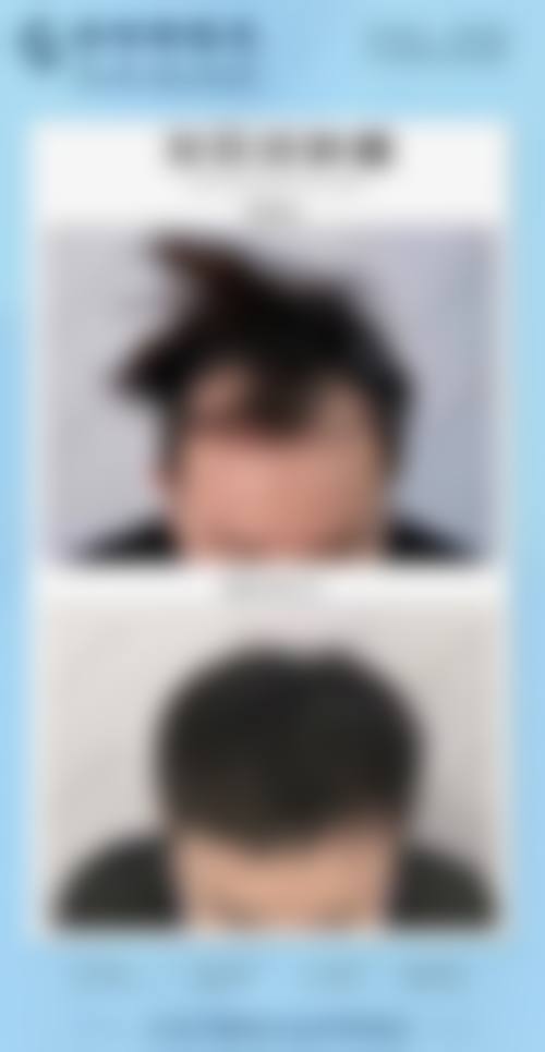 三、蒋友宁医生擅长项目与适合人群