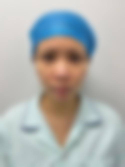 六、江门娇丽维漾医疗美容诊所手术成效